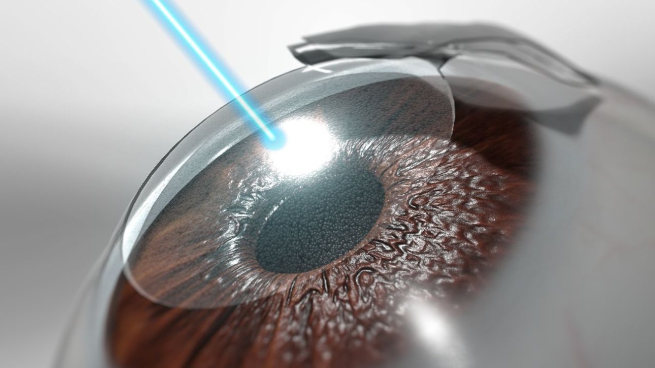 Application laser dans le traitement médical